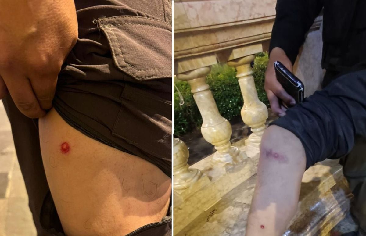 Fotoperiodista de El Comercio es herido por perdigones mientras cubría movilización