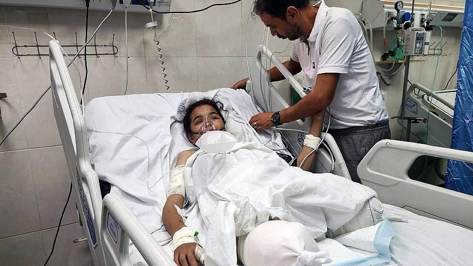 Razan Arafat Barbah en el hospital Nasser en Khan Yunis el 1 de octubre de este año. La niña perdió sus dos piernas tras un bombardeo israelí. (Getty Images).