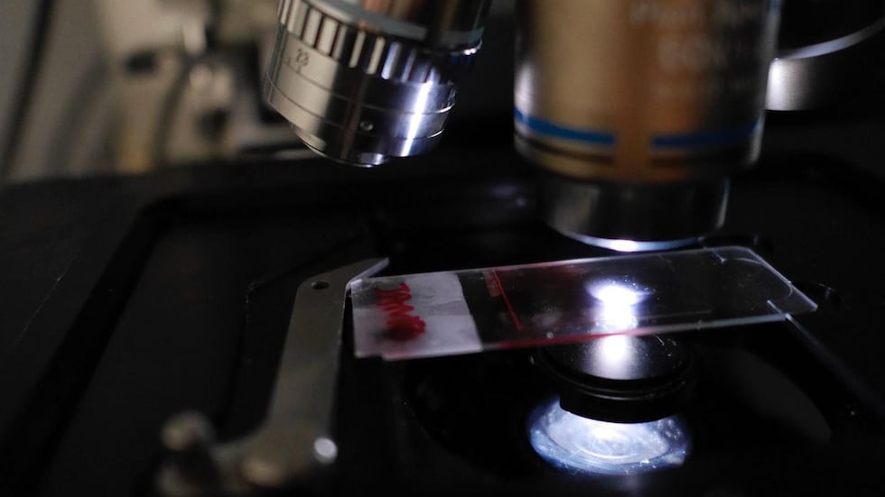 Los científicos vienen estudiando qué ocurre con las moléculas de contaminación que ingresan en nuestros cuerpos.