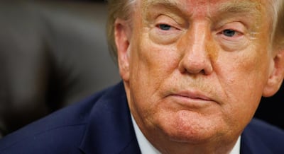 Trump insiste en su encuesta para cambiar el nombre de la inteligencia artificial