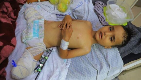 Ahmed Shabat, de 3 años, perdió sus piernas en una explosión en Gaza. (IBRAHIM ABU AMSHA).