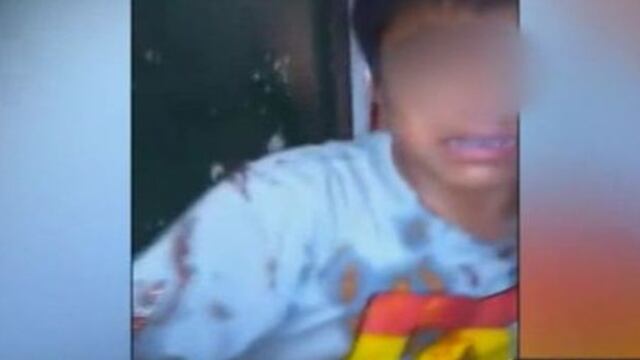 Niño fue agredido tras ingresar a un chifa para pedir comida