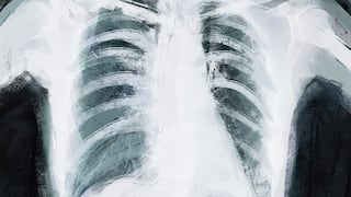 Día Mundial de la Radiología: ¿en qué se diferencia de la radioterapia?