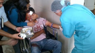 FOTOS: agreden brutalmente a periodista que denunció tráfico de terrenos en Chiclayo
