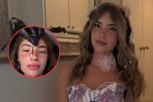 La drástica decisión de una influencer de San Diego al tatuarse ‘pecas’ en su rostro: el resultado genera elogios