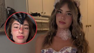 La drástica decisión de una influencer de San Diego al tatuarse ‘pecas’ en su rostro: el resultado genera elogios