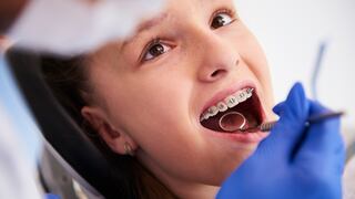 ¿Tu hijo iniciará un tratamiento de ortodoncia? Estos son los cuidados que debes tener en cuenta