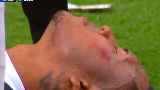 Pudo ser peor: Bryan Reyna sufrió un corte en el rostro | VIDEO
