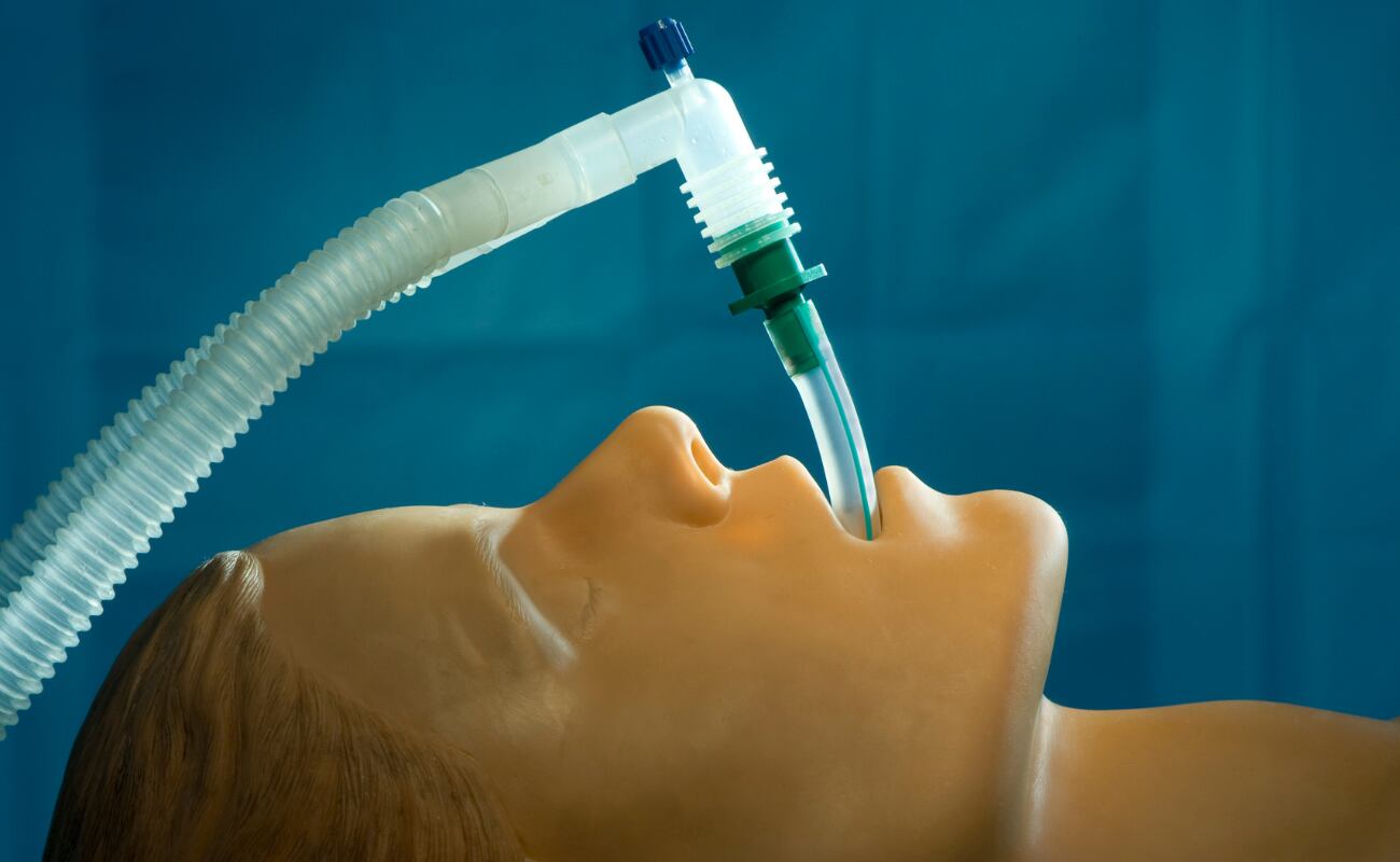 La app de este proyecto podría desarrollarse para ser usada por los médicos de las unidades de cuidados intensivos con el fin de reducir la tasa de fallos en el proceso de extubación y que al retirar el tubo, el paciente vuelva a tener aliento, respire y viva.