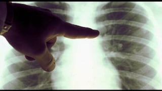 Crean tecnología 3D para diagnosticar enfermedades pulmonares