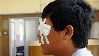 Aumentan casos de lesiones en los ojos por uso de pirotécnicos