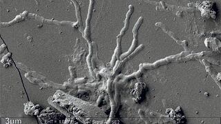 El “asombroso” descubrimiento de neuronas casi intactas en un cerebro en las ruinas de Pompeya y Herculano