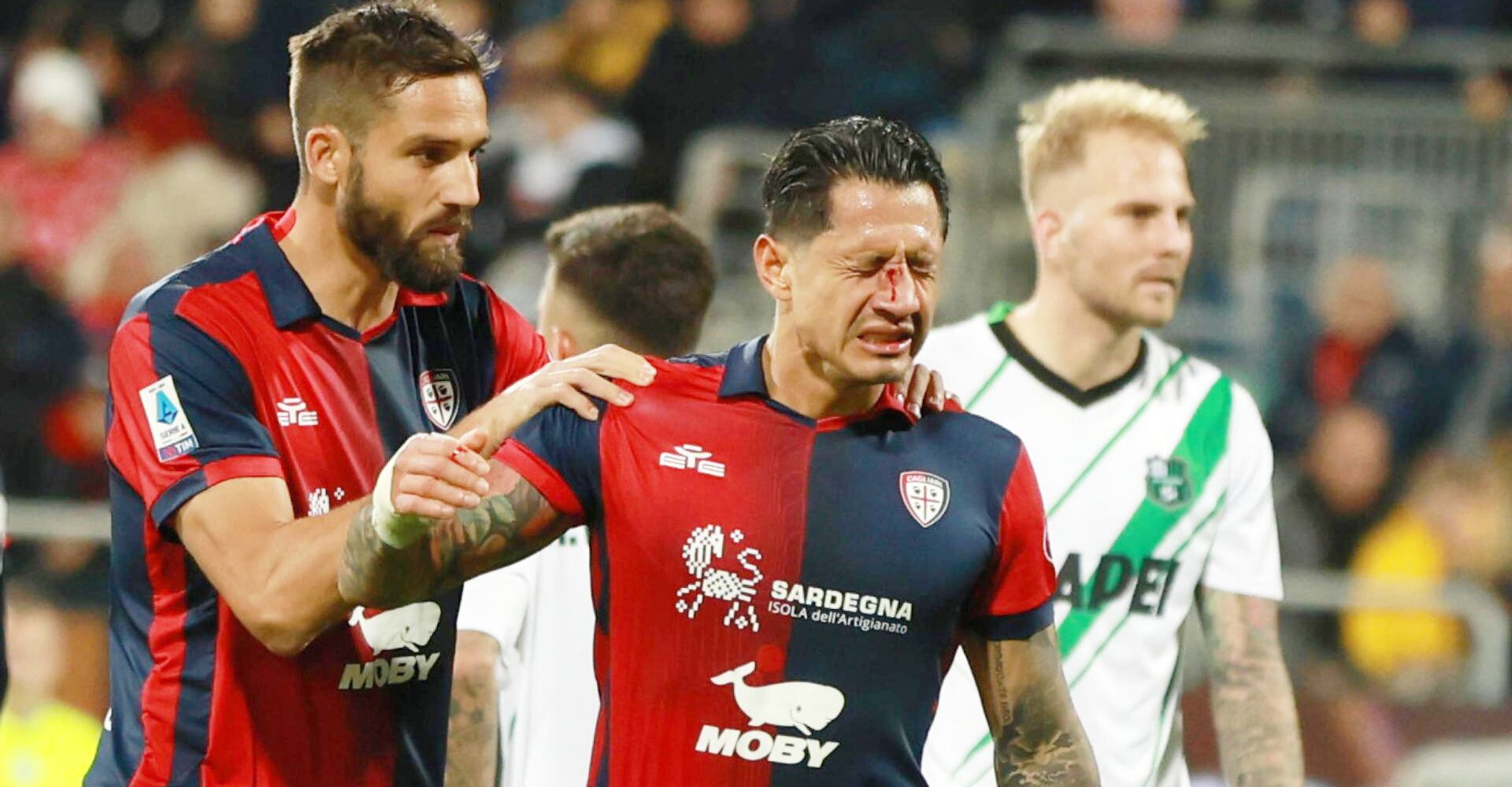 Lapadula ya se ha operado la nariz cinco veces (Foto: EFE).