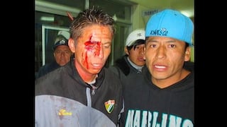 Sangre en la Copa Perú: falló un penal y casi lo linchan