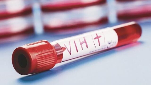 Reportan primer caso de paciente con VIH en remisión a largo plazo gracias a tratamiento experimental