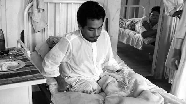 Pacientes de lepra eran atendidos en el local de San Pablo, a donde llegó El Comercio en 1960 con el Plan Perú. (Foto: GEC Archivo Histórico)