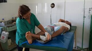 Picadura de rayas en Chiclayo: ¿A qué se debe el aumento de estos casos?