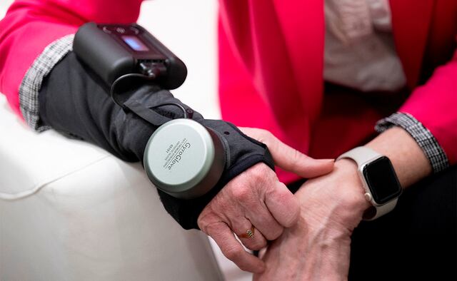 Este es el GyroGlove, fabricado por GyroGear, que utiliza un giroscopio para ayudar a estabilizar los temblores del Parkinson. Roberta Wilson-Garrett, de Blind River, Ontario, padece esta enfermedad, hizo una demostración. (Foto: AFP)