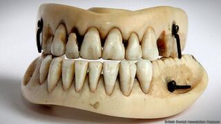 Los médicos que implantaban dientes de los muertos en Waterloo
