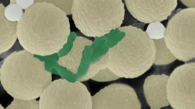 Enjambres de robots diminutos limpian microplásticos y microbios de forma simultánea