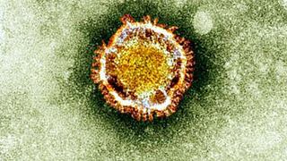 Coronavirus de Wuhan: ¿qué sabemos hasta ahora sobre esta enfermedad surgida en China?