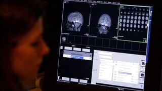 Crean implante cerebral que ayuda a mejorar la memoria en un 30%