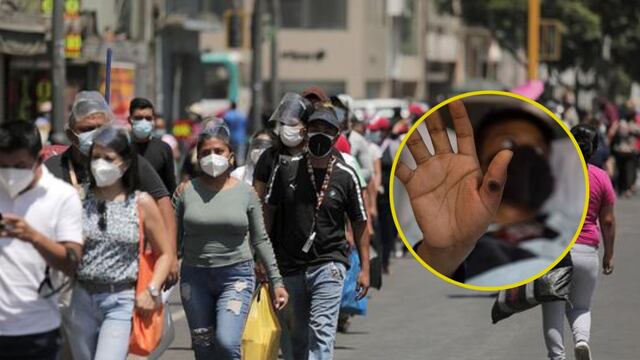 Los 3 distritos de Lima más afectados con contagios por la viruela del mono