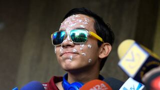 Venezuela: hasta 27 años de cárcel para policías que dejaron ciego a joven Rufo Chacón durante protesta