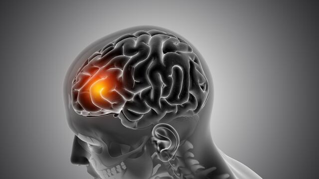 Tumores cerebrales: ¿Qué opciones de tratamientos existen?