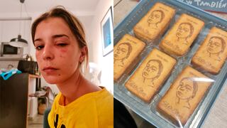 Le salió un orzuelo a su novia y plasmó su imagen en unas galletas: la singular broma que es viral en Twitter