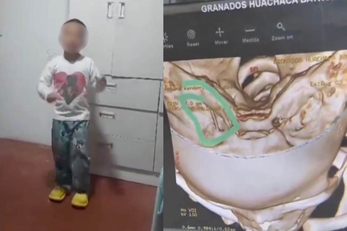 Los familiares protestan en los exteriores del nosocomio para exigir una rápida intervención. Foto: composición EC/captura América Noticias