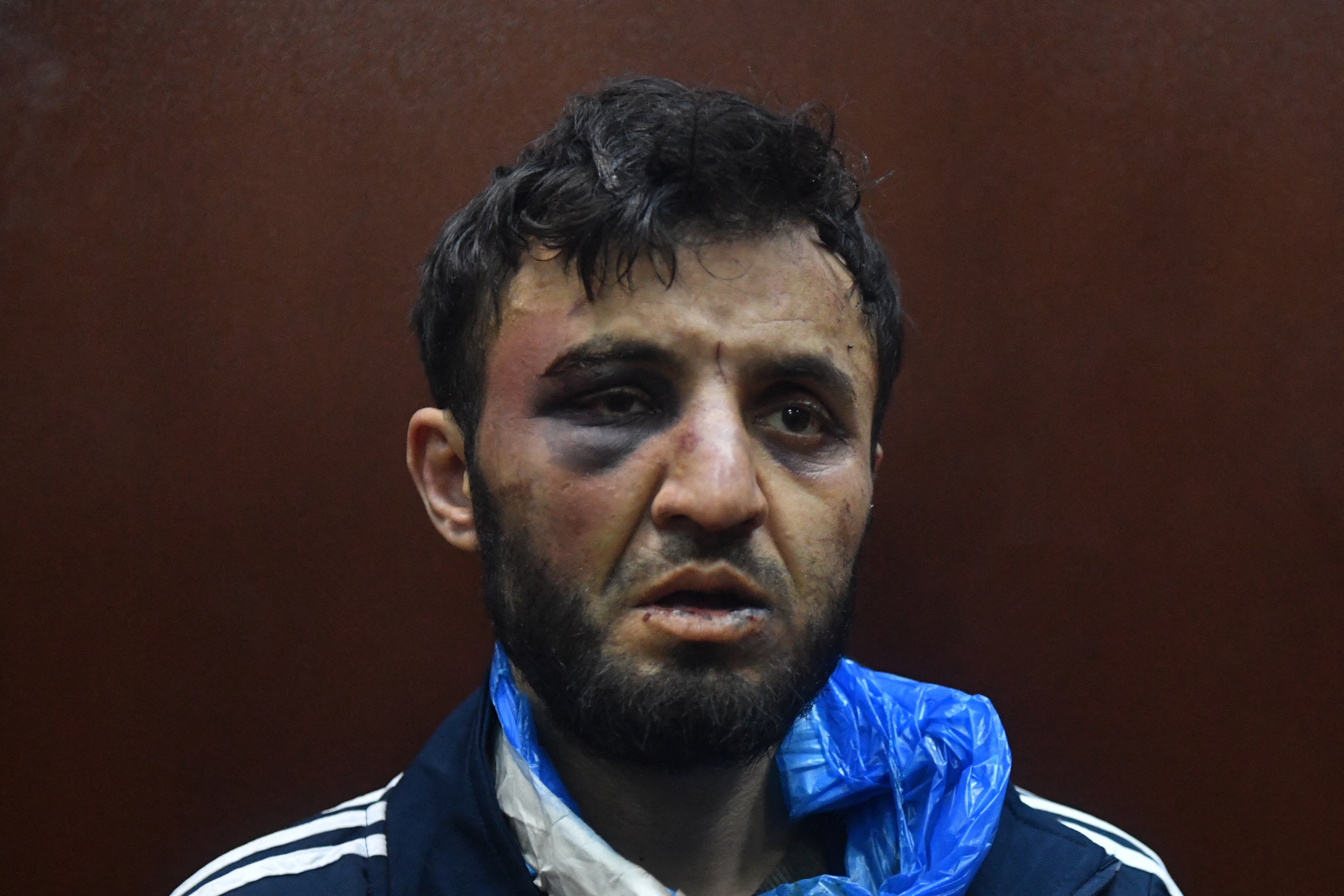 Dalerdjon Barotovich Mirzoyev, sospechoso de participar en el ataque a una sala de conciertos en Moscú, se sienta en la jaula del acusado mientras espera su audiencia de prisión preventiva en el Tribunal de Distrito de Basmanny. (Foto de Olga MALTSEVA / AFP).