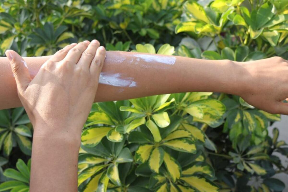 Atiende las quemaduras leves que aparecen en la piel por la exposición al sol con un remedio casero. (Foto: Minsa).