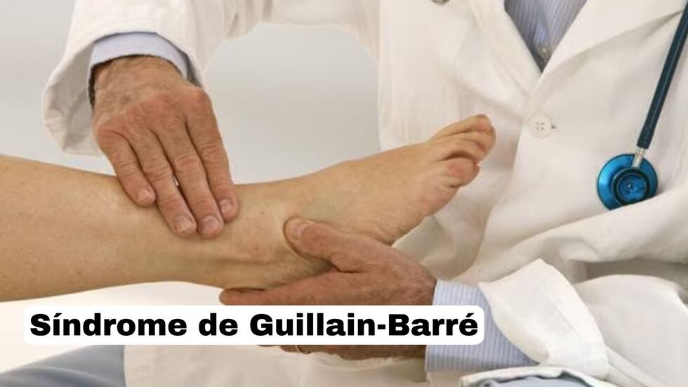 Síndrome de Guillain-Barré: cómo se produce el contagio, según el MINSA