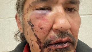 El violento arresto de un jefe indígena en Canadá que conmociona al país norteamericano