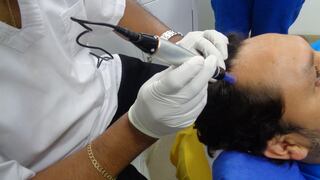 Salud y belleza: descubre cómo combatir la caída del cabello con mesoterapia capilar