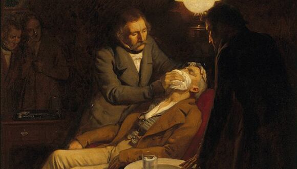 Ilustración del primer uso de éter como anestésico en 1846 por el cirujano dentista W.T.G. Mortón. (Pintura de Ernest Board)
