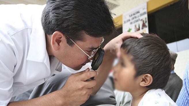 Los casos más comunes incluyen quemaduras y traumatismos, los cuales pueden provocar daños en la visión, ya sea de manera temporal o permanente. (Foto: Minsa)