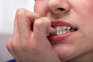 Víctor Lubin, dentista: comerte las uñas tiene estos terribles efectos en tu salud bucal
