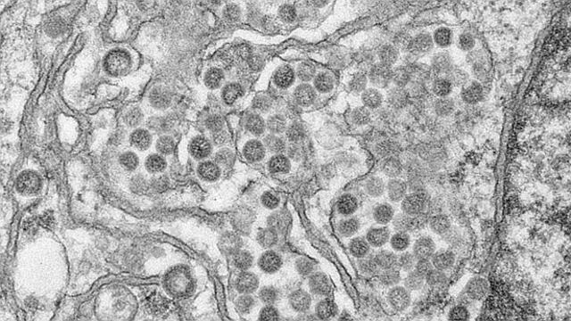 MERS: Científicos identifican anticuerpos del coronavirus