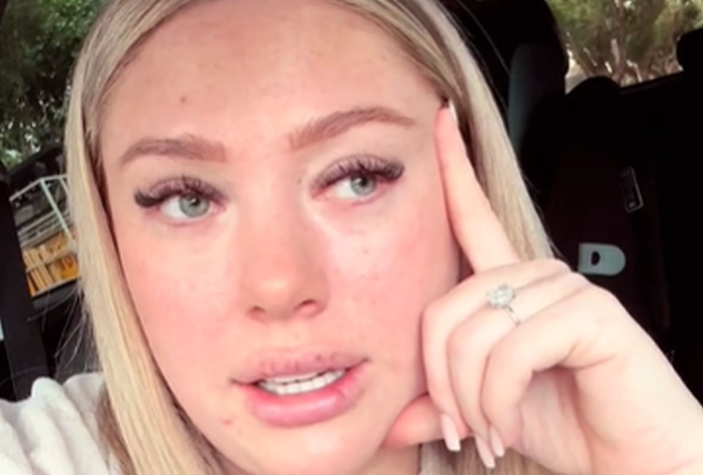 VIDEO VIRAL | En esta imagen aparece Lauren Smyth quien supo que tenía cáncer de piel luego de que le apareciera una pequeña mancha en la nariz. (Foto: @laurencarliesmyth / TikTok)
