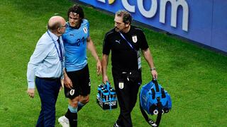 Uruguay vs. Francia: Edinson Cavani es duda para cuartos de final