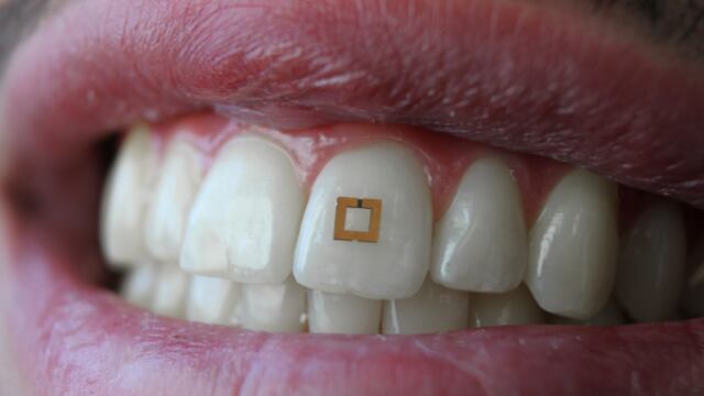 Diseñan dispositivo que se pega al diente para hacer diagnósticos