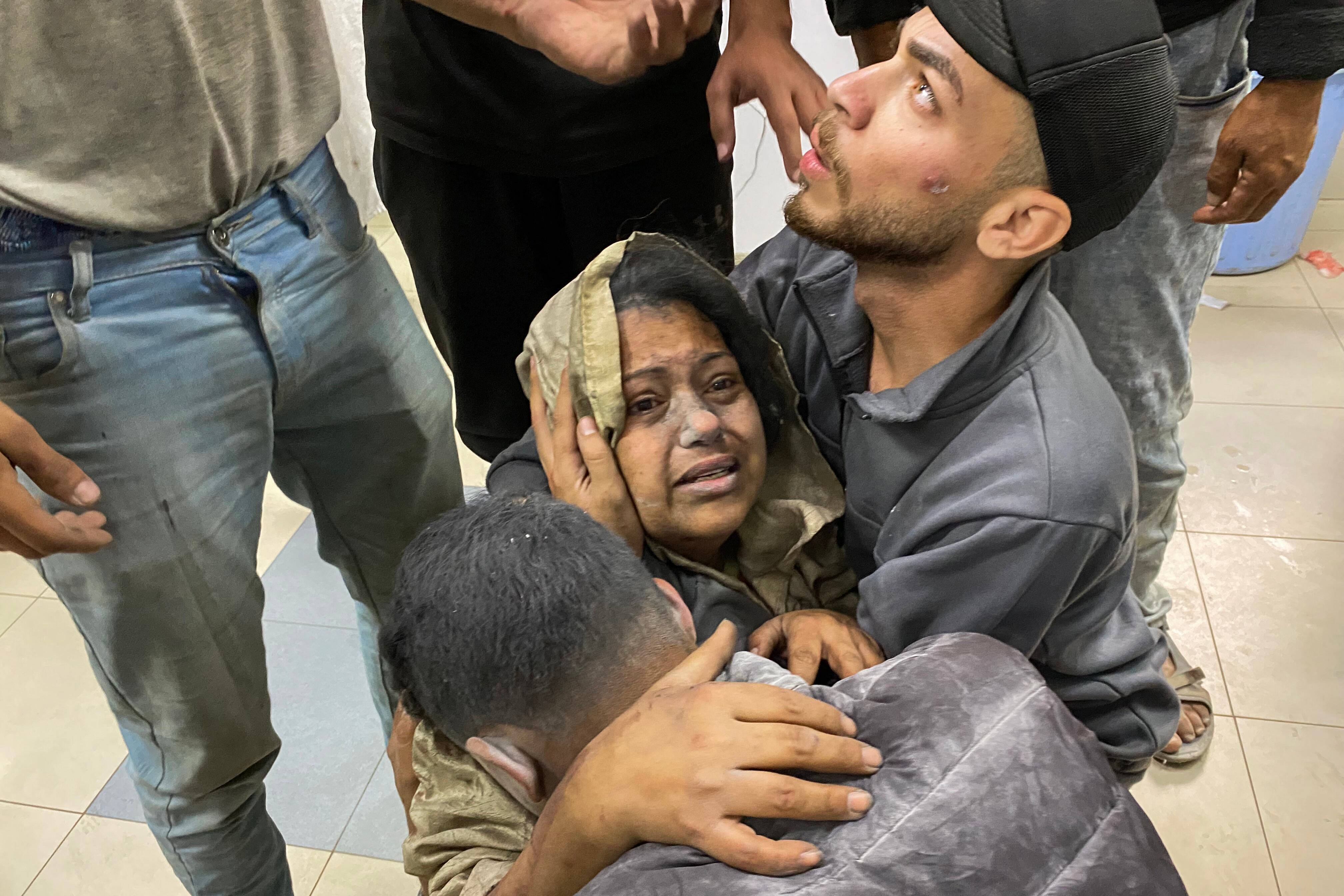 Palestinos heridos en ataques de Israel contra tiendas de campaña para desplazados en Khan Yunis, Gaza, reaccionan tras llegar al hospital Nasser, el 3 de junio de 2025. (Foto: AFP).