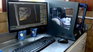 Cáncer: ¿Cómo se aplica la tecnología 3D a los pacientes?