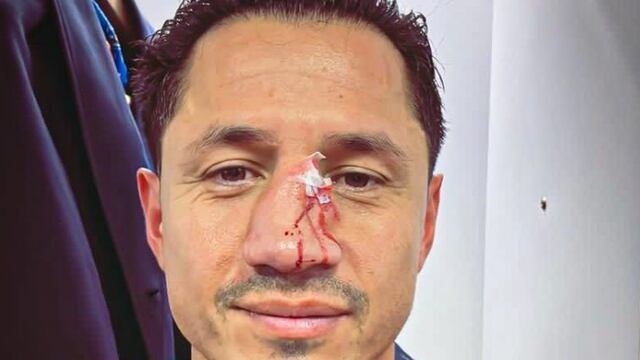 Lapadula volvió a ser operado de la nariz tras fuerte golpe que sufrió en el Cagliari vs. Sassuolo