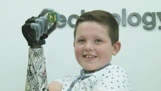 Brazo biónico devuelve movilidad a niño de nueve años