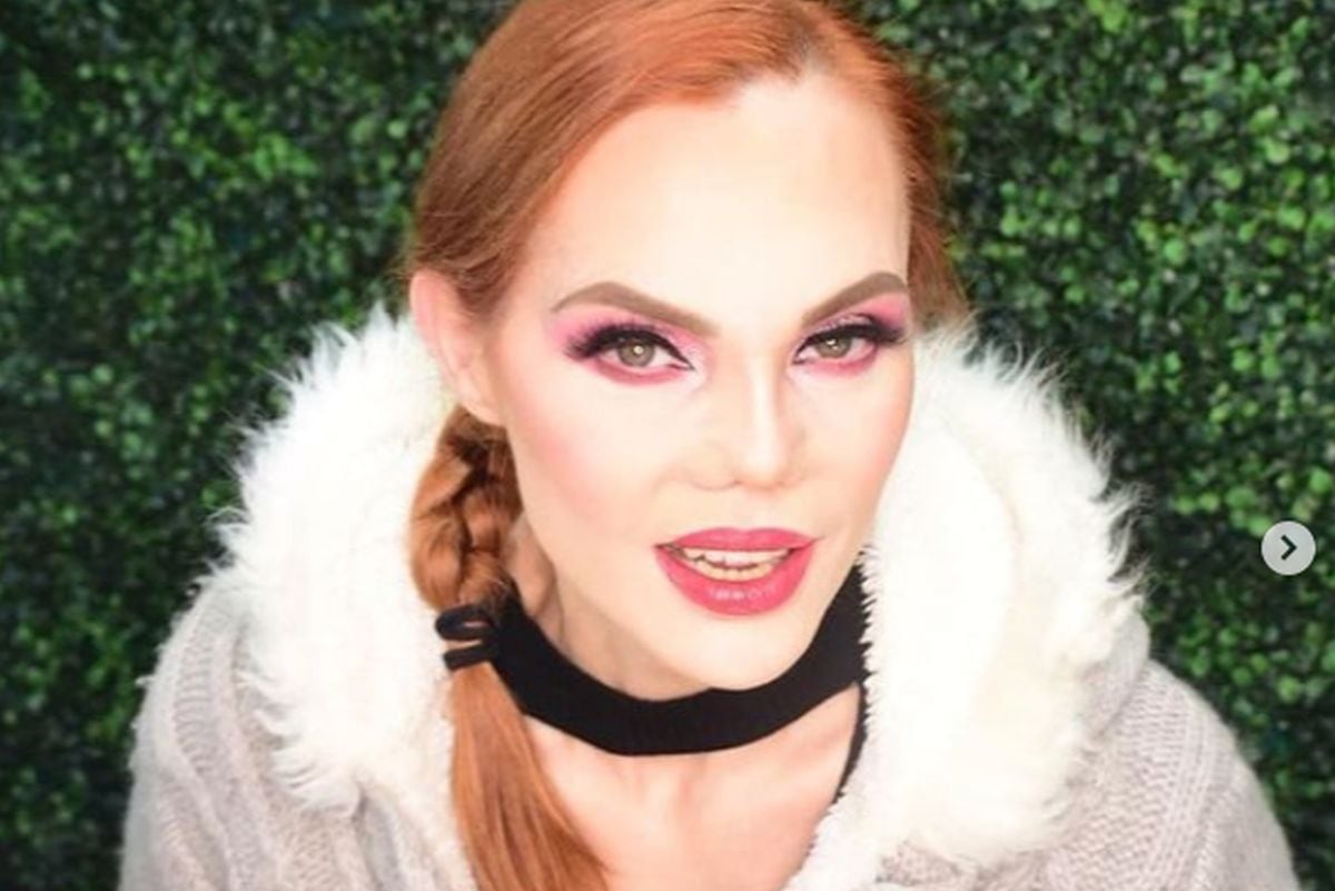 Actriz ha luchado mucho por reconstruir su nariz (Foto: Carmen Campuzano / Instagram)