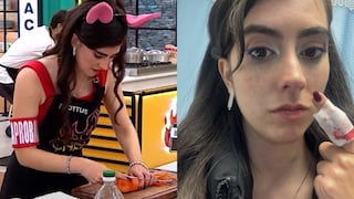 “El Gran Chef Famosos”: Matilde León sufrió profundo corte y tuvo que dejar la competencia
