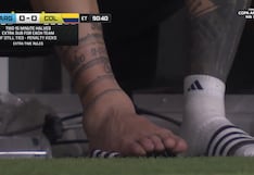 ¡Impactante! Así quedó el tobillo de Lionel Messi en el Argentina vs. Colombia por Copa América | VIDEO